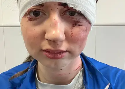 Лыжница из Томска, Дарья Ермакова пострадала при массовом завале спортсменок на соревнованиях в Сочи