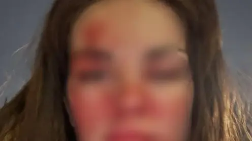 Известный красноярский стоматолог избил свою жену в центре города