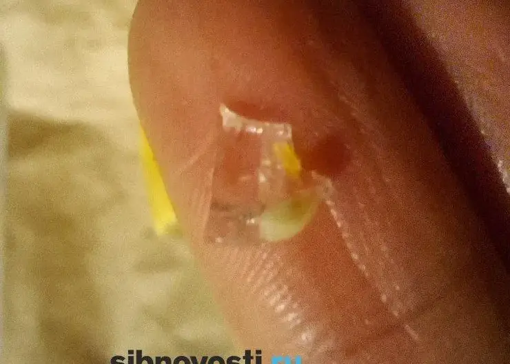 «Порезан рот, больно есть и пить». Ресторан угостил красноярку блюдом со стеклом