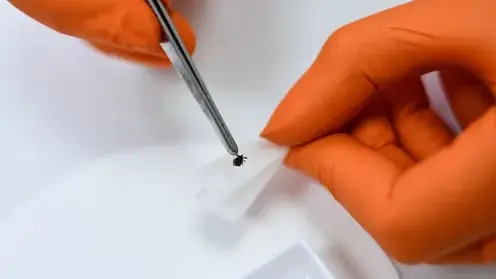 С начала года в Забайкальском крае зарегистрировано 3 117 обращений граждан после укусов клещей