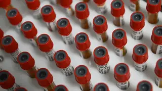 Диагностику рака крови сделают доступнее благодаря разработке учёных из Красноярска Диагностику рака крови сделают доступнее благодаря разработке учёных из Красноярска