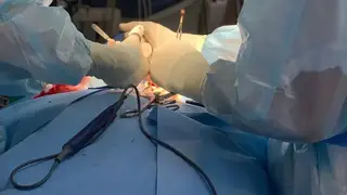 Красноярские хирурги прооперировали пациентку с редким заболеванием