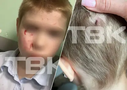 Красноярцы «респектуют» отцу, избившему обидчиков сына стулом. И рассказывают свои истории травли