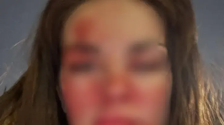 Известный красноярский стоматолог избил свою жену в центре города