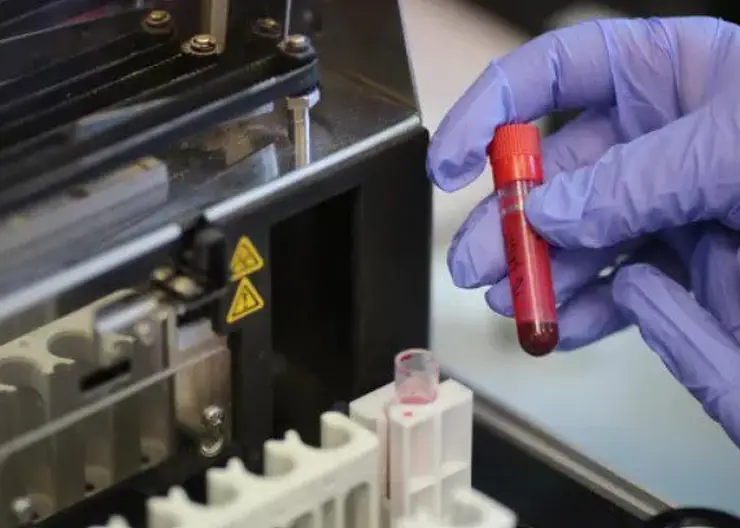 В Шарыповской горбольнице начнут делать биопсию