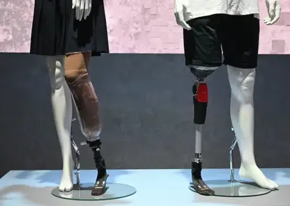 Российские ученые разработали «умные» протезы, усиленные углеродным волокном