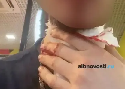 «У меня горло перерезано»: красноярец, на которого напал мужчина с ножом, рассказал как это было