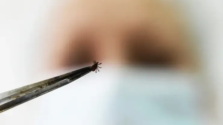 «Наноклещей» не существует: специалисты Роспотребнадзора рассказали о маленьких кровососах в Красноярском крае
