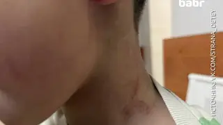 В Иркутской области учитель физкультуры подозревается в избиении ребенка в детском саду В Иркутской области учитель физкультуры подозревается в избиении ребенка в детском саду