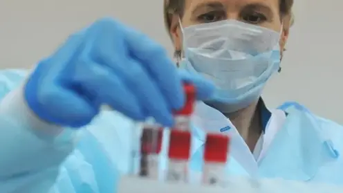 ВИЧ-инфекцию впервые выявили у 450 человек в Красноряском крае