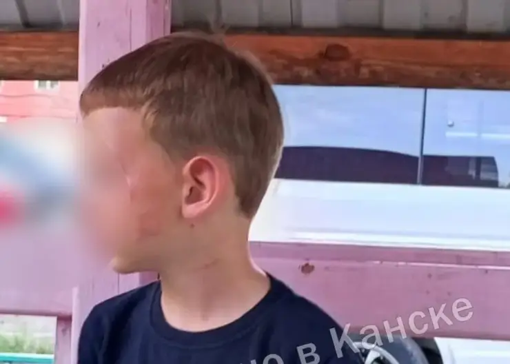 Жительницу Канска, истязавшую малолетнего сына, отправят на принудительное лечение