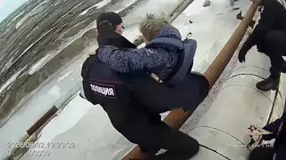 Рваные раны и ссадины: подростки из Норильска рассказали о стычке с бездомными собаками