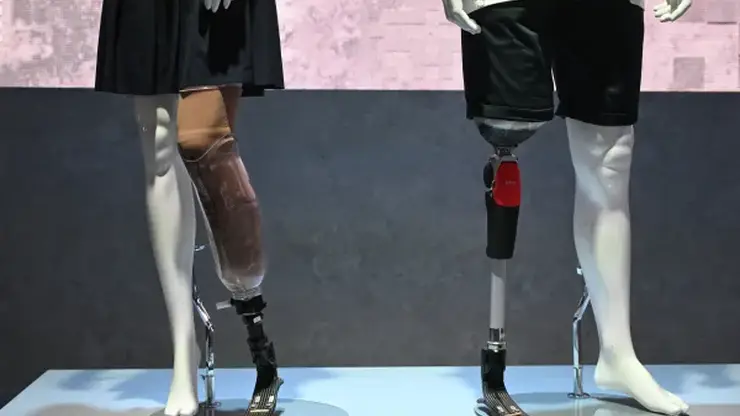 Российские ученые разработали «умные» протезы, усиленные углеродным волокном