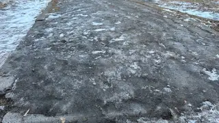 В Томске 163 ребёнка травмировались за 4 дня В Томске 163 ребёнка травмировались за 4 дня