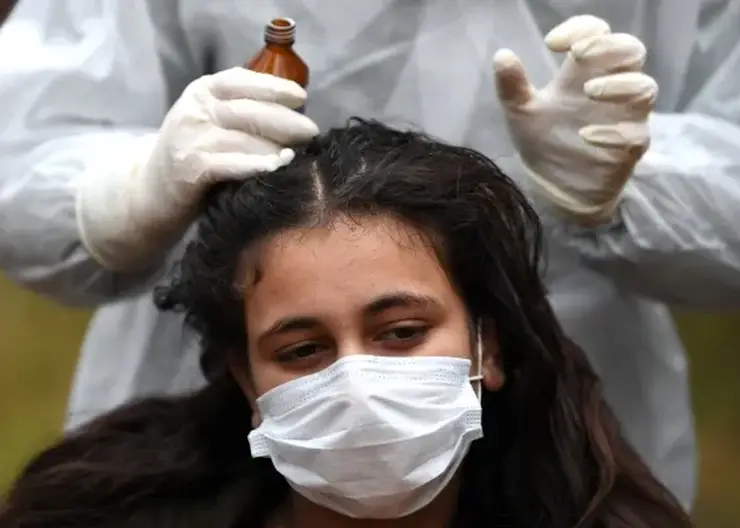 Сезон вшей начинается в Томской области