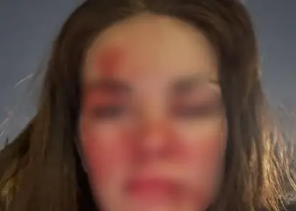 Известный красноярский стоматолог избил свою жену в центре города