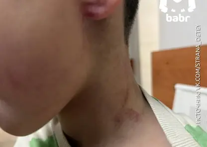 В Иркутской области учитель физкультуры подозревается в избиении ребенка в детском саду