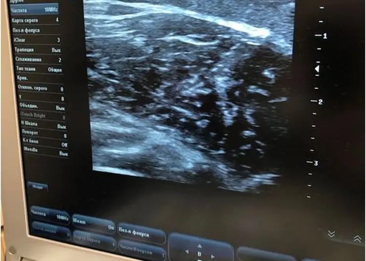 Красноярские медики начали использовать ботулинотерапию для реабилитации пациентов после инсульта