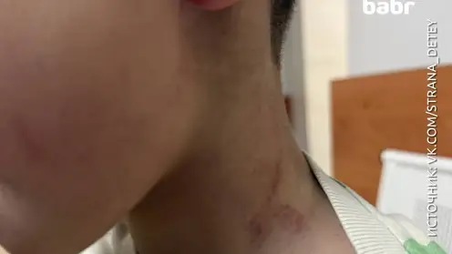 В Иркутской области учитель физкультуры подозревается в избиении ребенка в детском саду