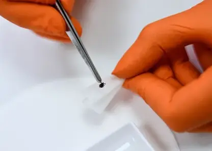 С начала года в Забайкальском крае зарегистрировано 3 117 обращений граждан после укусов клещей