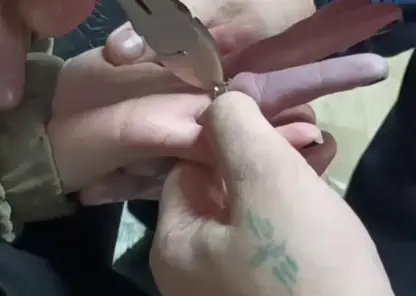 Новосибирские спасатели помогли девушке снять кольцо с отёкшего пальца