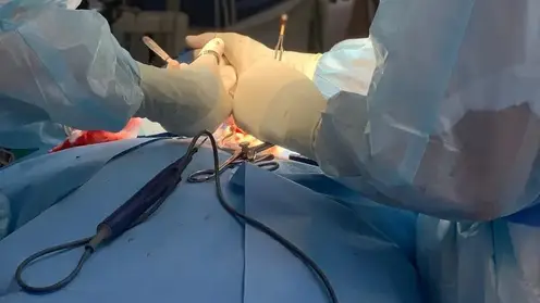 Красноярские хирурги прооперировали пациентку с редким заболеванием