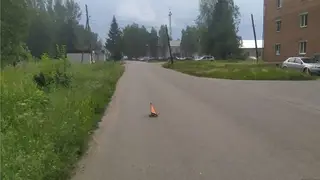 11-летний мальчик попал в реанимацию после катания на самокате в Красноярском крае 11-летний мальчик попал в реанимацию после катания на самокате в Красноярском крае