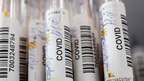 Красноярцам рассказали о необходимости при признаках ОРВИ проходить тест на коронавирус