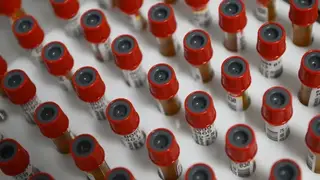 Диагностику рака крови сделают доступнее благодаря разработке учёных из Красноярска Диагностику рака крови сделают доступнее благодаря разработке учёных из Красноярска