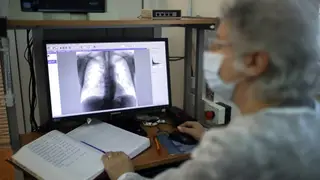Летом красноярцы смогут пройти флюорографию в передвижных пунктах Летом красноярцы смогут пройти флюорографию в передвижных пунктах